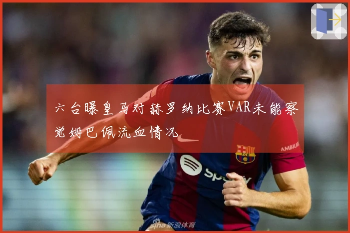 六台曝皇马对赫罗纳比赛VAR未能察觉姆巴佩流血情况